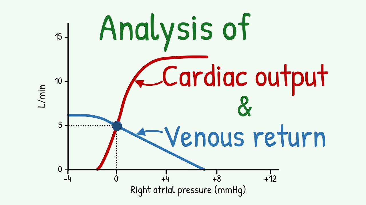 Smart Guide to How to Calculate Cardiac Output: Effective Methods for 2025